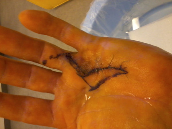 hand1.jpg